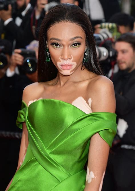 Winnie Harlow